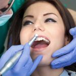 La estética dental va ganando adeptos con los años